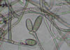 Bipolaris_mold
