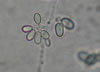 Botrytis_mold