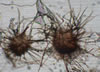 Chaetomium_mold