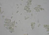 Cladosporiumi mold