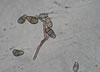 Curvularia_mold