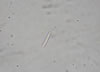Fusarium_mold