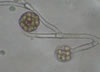 Mucor_mold