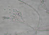 Penicillium_mold