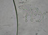 Scopulariopsis_mold