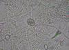 Sporotrichum_mold