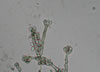 Stachybotrys_mold