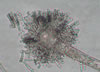 Syncephalastrum_mold