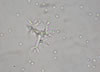 Torula_mold