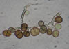 Ulocladiumima_mold